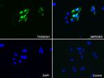 GFAP Antibody in Immunocytochemistry (ICC/IF)