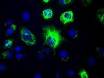 GFAP Antibody in Immunocytochemistry (ICC/IF)