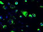 GFAP Antibody in Immunocytochemistry (ICC/IF)