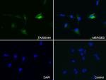 GFAP Antibody in Immunocytochemistry (ICC/IF)