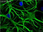 GFAP Antibody in Immunocytochemistry (ICC/IF)