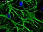 GFAP Antibody in Immunocytochemistry (ICC/IF)