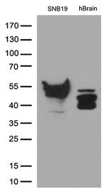 GFAP Antibody in Western Blot (WB)