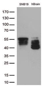 GFAP Antibody in Western Blot (WB)