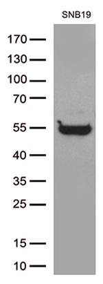 GFAP Antibody in Western Blot (WB)