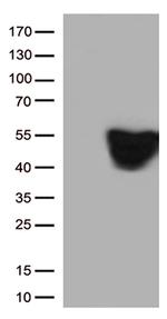 GFAP Antibody in Western Blot (WB)
