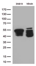 GFAP Antibody in Western Blot (WB)