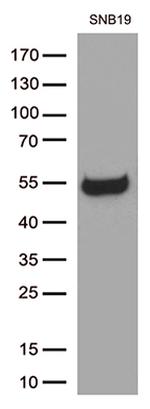 GFAP Antibody in Western Blot (WB)