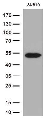 GFAP Antibody in Western Blot (WB)
