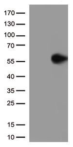 GFAP Antibody in Western Blot (WB)
