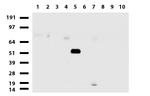 GFAP Antibody in Western Blot (WB)