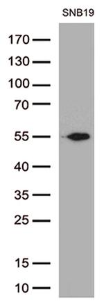 GFAP Antibody in Western Blot (WB)