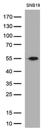 GFAP Antibody in Western Blot (WB)