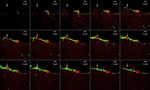 GFAP Antibody in Immunohistochemistry (IHC)