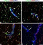 GFAP Antibody in Immunohistochemistry (IHC)