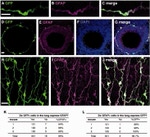 GFAP Antibody in Immunohistochemistry (IHC)