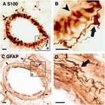 GFAP Antibody in Immunohistochemistry (IHC)