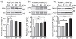 GFAP Antibody in Western Blot (WB)