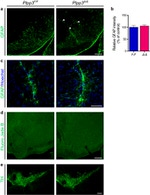 GFAP Antibody in Immunohistochemistry (IHC)