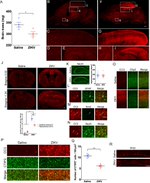 GFAP Antibody in Immunohistochemistry (IHC)