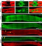GFAP Antibody in Immunohistochemistry (IHC)