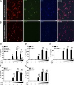 GFAP Antibody in Immunocytochemistry (ICC/IF)