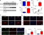 GFAP Antibody in Western Blot (WB)