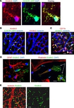 GFAP Antibody in Immunohistochemistry (IHC)