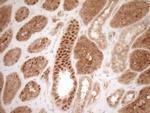 GFI1 Antibody in Immunohistochemistry (Paraffin) (IHC (P))
