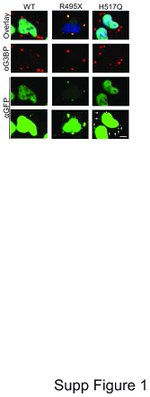 GFP Antibody in Immunocytochemistry (ICC/IF)