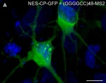 GFP Antibody in Immunocytochemistry (ICC/IF)