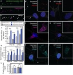 GFP Antibody in Immunocytochemistry (ICC/IF)