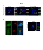 GFP Antibody in Immunocytochemistry (ICC/IF)