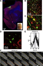GFP Antibody in Immunohistochemistry (IHC)
