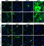 GFP Antibody in Immunocytochemistry (ICC/IF)