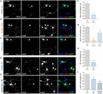 GFP Antibody in Immunocytochemistry (ICC/IF)