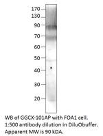 GGCX Polyclonal Antibody