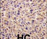 GGPS1 Antibody in Immunohistochemistry (IHC)