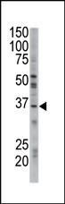 GGPS1 Antibody in Western Blot (WB)