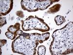 GH2 Antibody in Immunohistochemistry (Paraffin) (IHC (P))