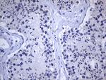 GH2 Antibody in Immunohistochemistry (Paraffin) (IHC (P))