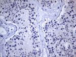GH2 Antibody in Immunohistochemistry (Paraffin) (IHC (P))