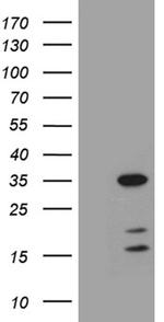 GH2 Antibody in Western Blot (WB)