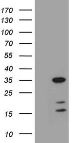 GH2 Antibody in Western Blot (WB)
