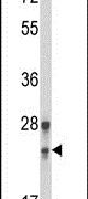 GINS1 Antibody in Western Blot (WB)