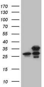 GINS3 Antibody in Western Blot (WB)