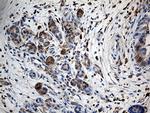 GIPC1 Antibody in Immunohistochemistry (Paraffin) (IHC (P))