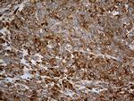 GIPC1 Antibody in Immunohistochemistry (Paraffin) (IHC (P))