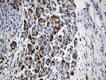 GIPC1 Antibody in Immunohistochemistry (Paraffin) (IHC (P))
