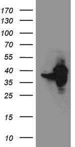 GIPC1 Antibody in Western Blot (WB)